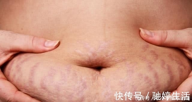 肚子|怀孕期间，必须要注意的几种情况，否则很容易让肚子“变丑”