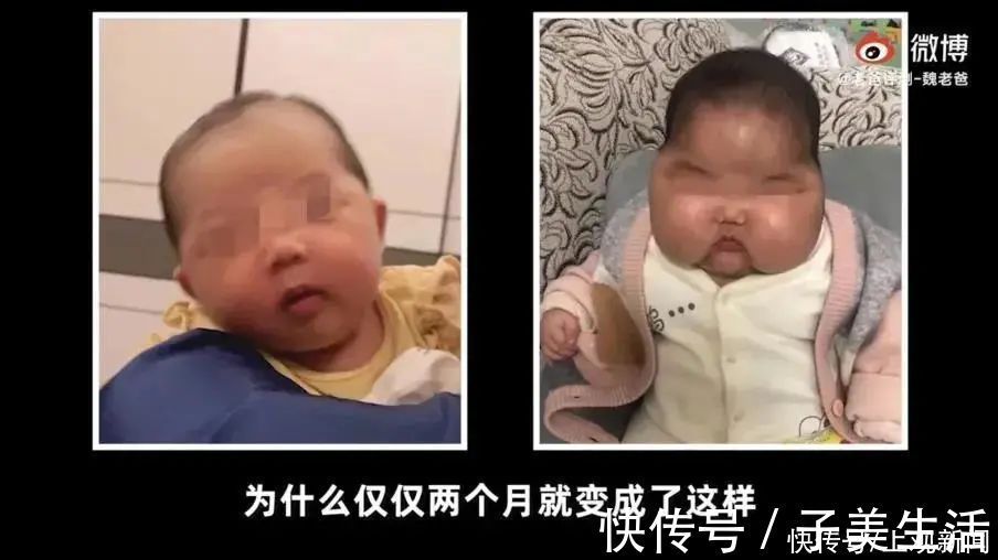 保湿|某款抑菌霜涂出“大头娃娃”,新华医院网红药膏还能用吗?