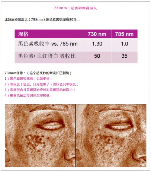 祛斑|涨知识：激光祛斑一定要「结痂」才有效？