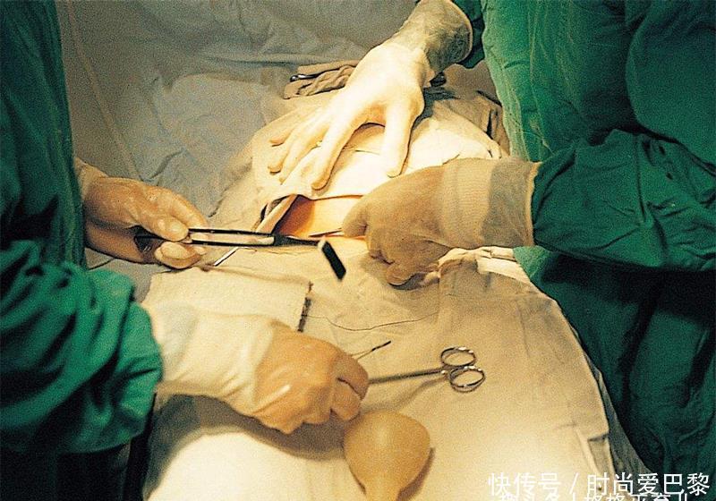 妈妈们|剖腹产只是“挨一刀”吗?术后恢复期有哪些要注意的?