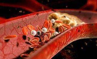 中老年人|常吃“腐乳”的人,会有什么变化多数人还不清楚,答案让人意外