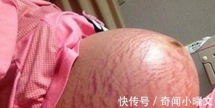 产妇|国外48岁高龄产妇怀上龙凤胎,可宝宝出生后,她却觉得天要塌了