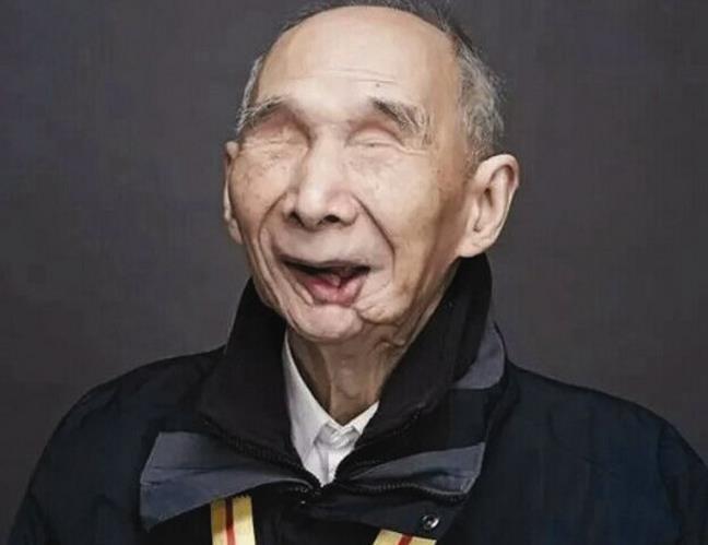 素食|高血脂不能吃土豆?医生提醒:一旦血脂偏高,这3种素食也要忌口