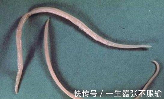 家长们|小孩子身上出现这四种症状,可能是有蛔虫了,作为家长们要注意