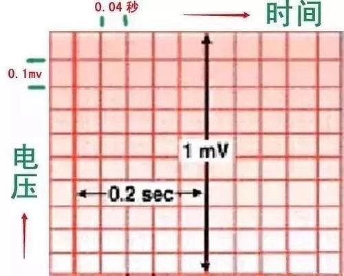 护士这样学心电图，不用死记硬背