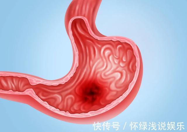 胃病|吃出来的老胃病，怎么养才不复发？养胃，中医有妙招