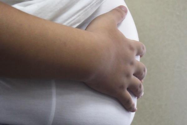 肥胖|五种常见食物,热量堪比“喝油”,肥胖的人不要吃