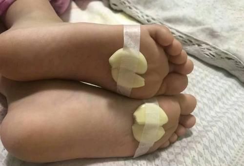 生活中常吃的大蒜，还有以下3种妙用，看看你见识过吗？