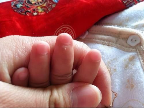 宝宝手上长倒刺，有个常见小动作可能带来危险，正确处理就三步