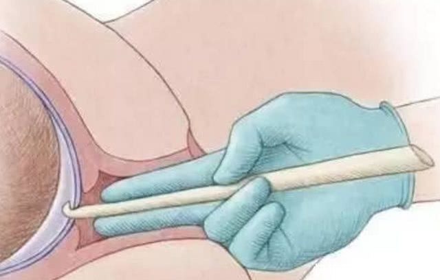 准妈妈|顺产时不顺利的会有哪一些措施,各位准妈妈们了解多少