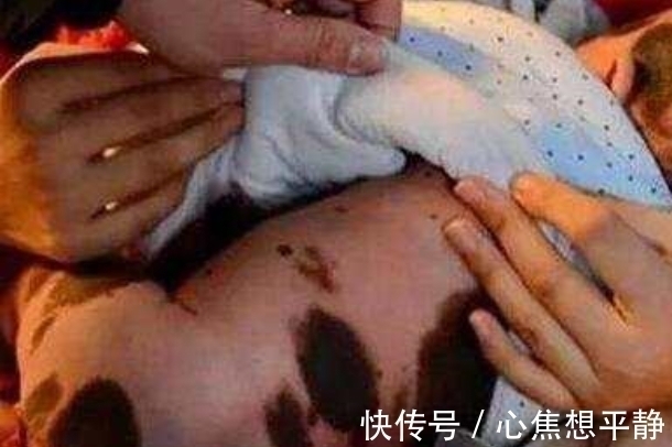 宝宝|27岁女子生下宝宝,家人见到哭泣,医生道出真相