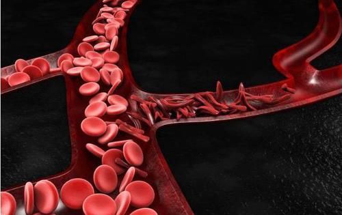  原因|经常手脚冰凉，或是两个原因导致的，教你3个调理方法，不妨试试