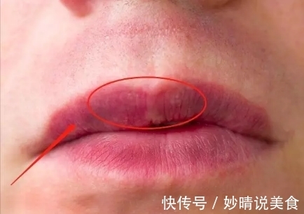 女性朋友|有妇科疾病的女人,嘴巴可能有4种表现,你若没有,身体很健康