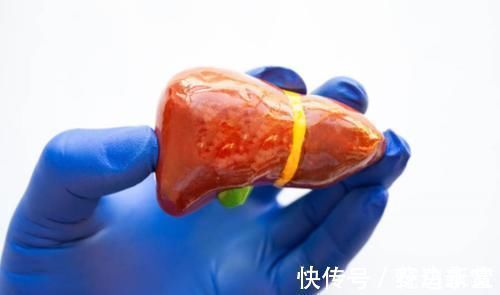 肝火过旺|肝火过旺的人,一般会有3种表现,若能注意两点,比吃啥都管用