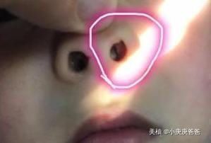 阳台上|3岁女孩浑身散发恶臭,妈妈带去医院检查当场作呕,原因令人害怕