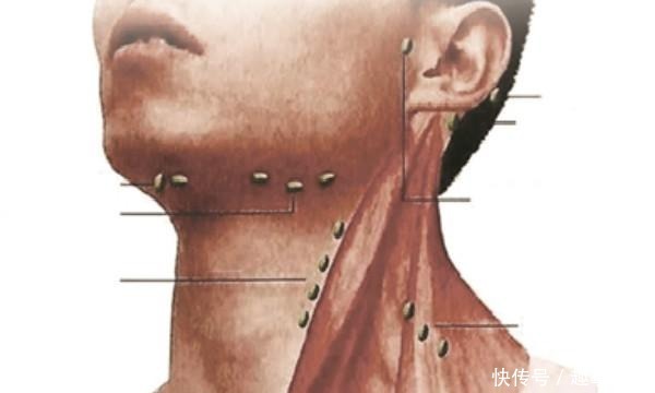 死亡|同样是胃癌,为什么有的人胃癌术后没复发,有的却因复发死亡?