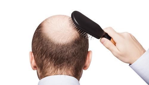 前列腺|男性身体出现4个信号，提示你开始衰老，若没有，说明你还年轻