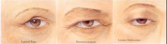 眼周状态出卖了你的年龄!