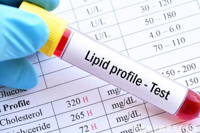  李先生|62岁心内科主任公开，从甘油三酯5.6到正常，只因常吃一种“酸”