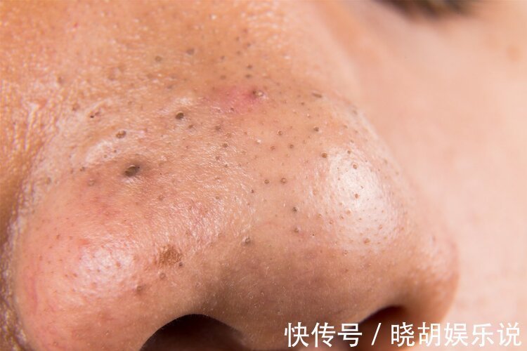 骨质疏松症|男人雄性激素低,身体会出现这3种异常,吃4种食物恢复男人本色