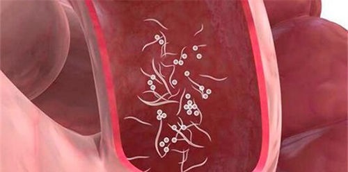 感染|2岁女儿患上“蛲虫病”,得知原因后,宝妈直接气得带孩子回娘家