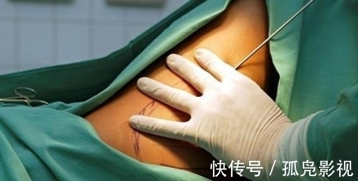 身亡 “裹小脚”式审美!33岁网红“手术抽脂”身亡:ICU内熬了2个月!