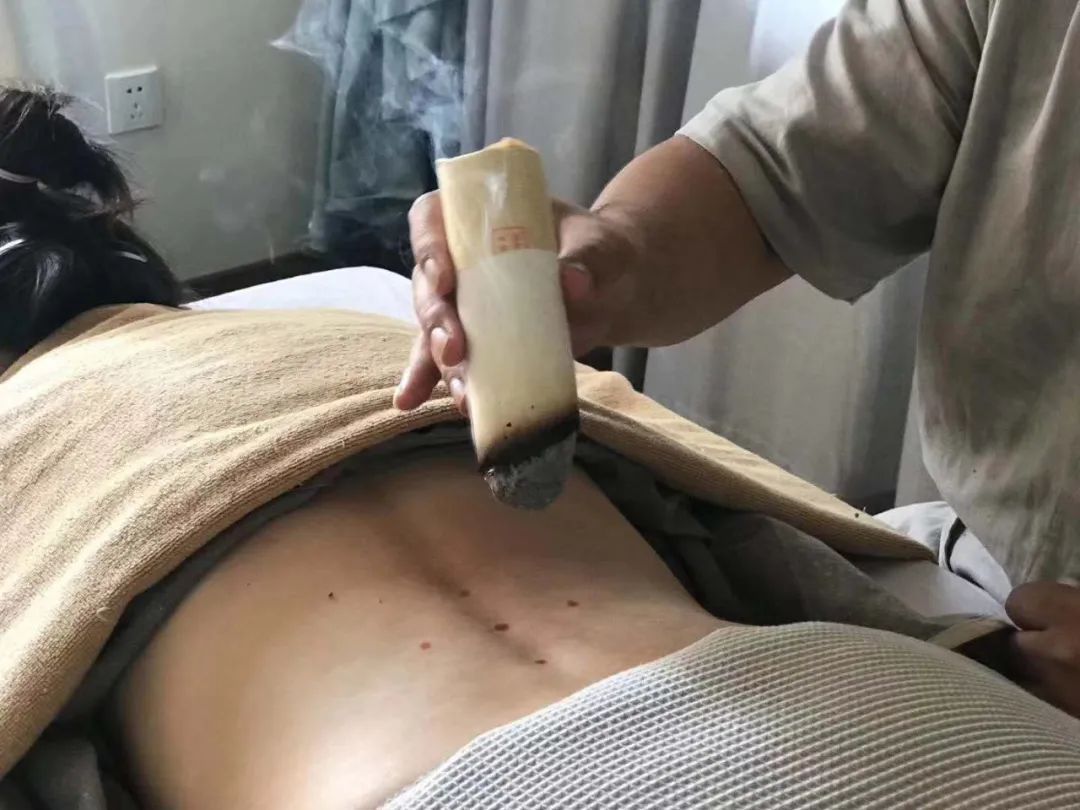 痰多百病生!中医3招,祛除痰湿,调和气血,让你年轻态、少生病