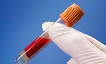 产检时，医院让做的这项检查，或许费钱还受罪，孕妈不要被安排