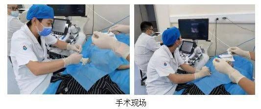 浆膜腔积液|齐鲁医典|山东大学齐鲁儿童医院超声介入手术室正式投入使用