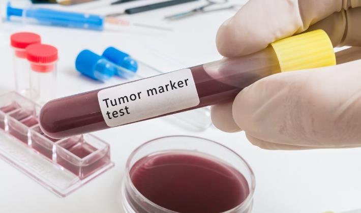 肿瘤|体检查出肿瘤标志物高，这意味着患癌吗？听听医生怎么说