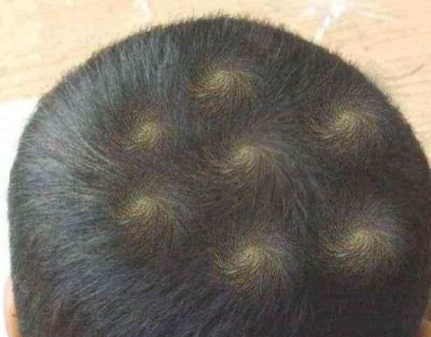 孩子头顶|为什么有的孩子头上有“2个旋”？代表什么意思，看完涨知识了