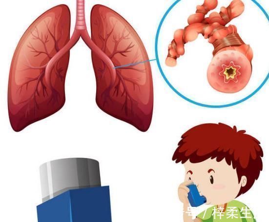 健脾|脾肺不好止咳难,每天温水泡1物,孩子喝了,健脾润肺、化痰止咳