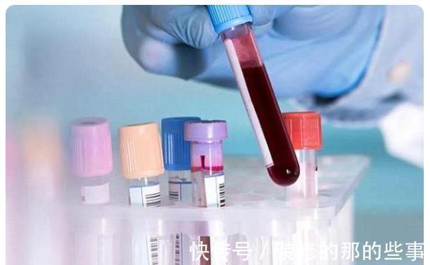 智商|血型真的影响智商吗,这四种高智商血型排名,你的孩子排第几