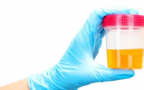 血糖|糖尿病患者的尿又黄又骚是什么原因?你真的知道吗?看专家的理解