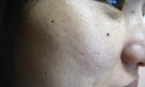 睡眠质量|肺功能差的人，身上大多存在3个“共性”，若你有，及时调理