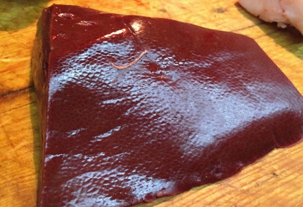 肌瘤|为何会患子宫肌瘤女性有子宫肌瘤别发愁,常吃3物,可养好子宫