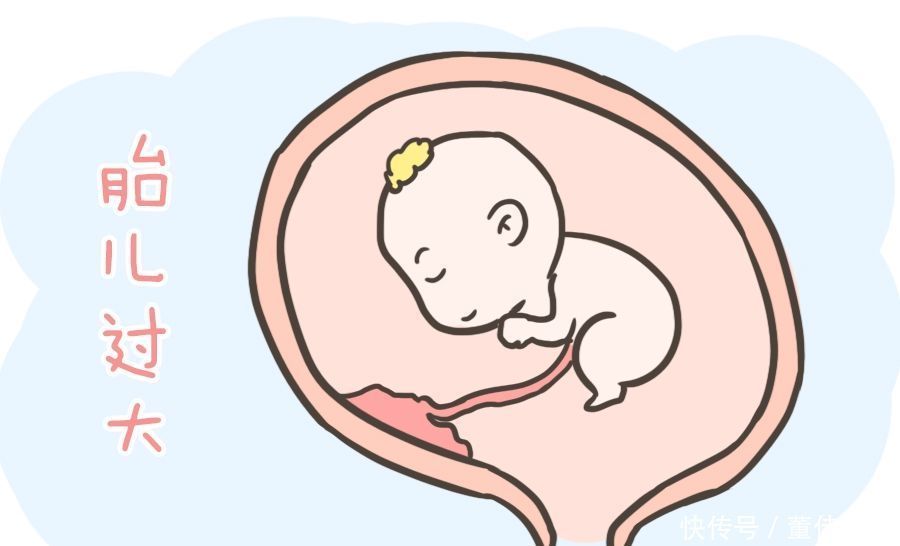 准妈妈第一胎如果是剖宫产，那么第二胎该怎么生看完这篇就懂了