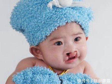 产妇生出“兔唇儿”,谎称孕期吃了兔肉,被医生揭穿后婆婆很恼火