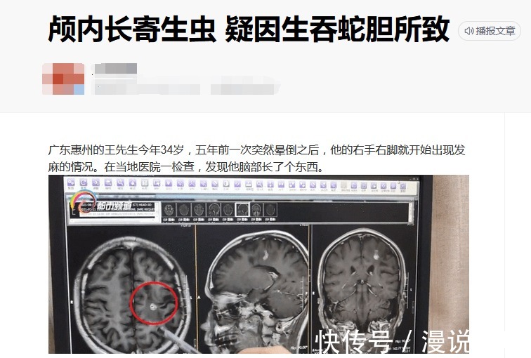 胆汁|治病不成反要命?盘点这5种民间偏方,在2022年可别再次上当!