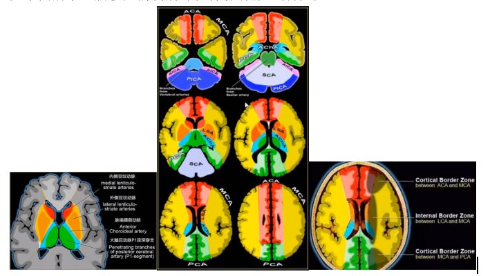 大脑血管疾病|5大脑血管疾病的MRI表现，一文总结