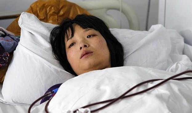 肾脏疾病|尿毒症可能吃出来的,不要贪吃三种食物,肾脏可能会感激你!