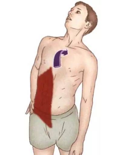 腹外斜肌|你要的拉筋，都在这里！