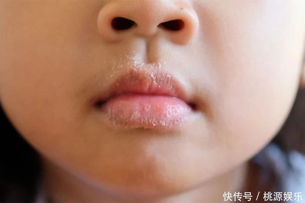 因为1个习惯动作，5岁男童被抽血4次，这个安全隐患宝妈快自查