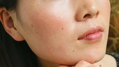 食物|气血不足多半会长斑,多吃4种食物,或让皮肤白嫩更年轻