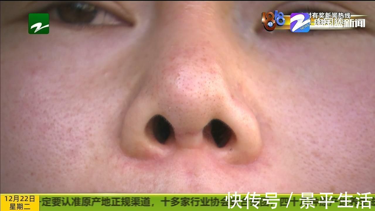 罗女士|修复后变“朝天鼻”“佰丽医美”已注销 对整形不满该怎么办?