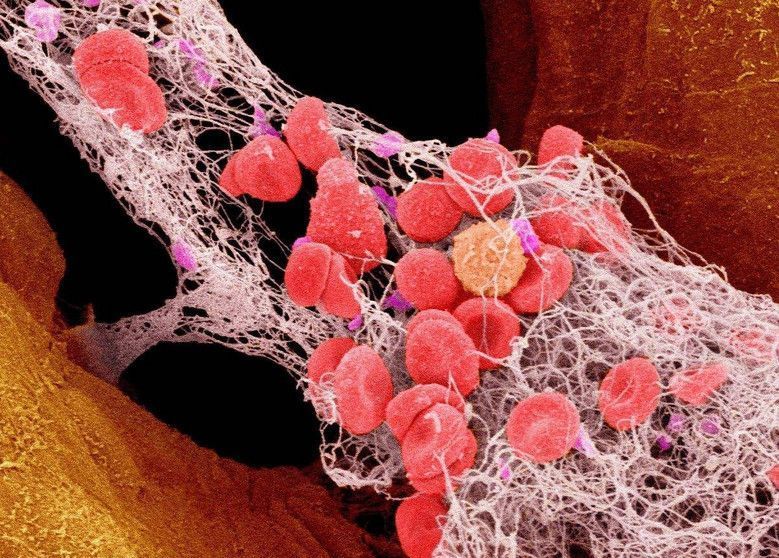 血液粘稠|血液粘稠的“稀释剂”找到了,早晚坚持吃几口,血液不稠血栓不扰