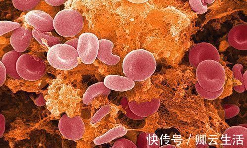 桃子|血液黏稠的人，饭后有3种“现象”，若都没有，说明血管还算通畅