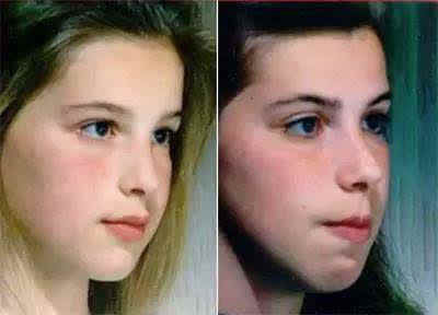 容貌|孩子的“容貌”几岁定型?到这个年龄后,颜值不会有太大变化