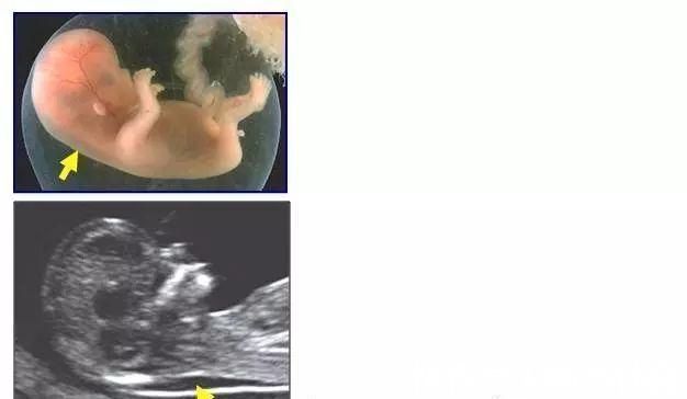 建档|怀孕后孕检口诀1建,1筛,2查,3超少不了,宝宝健康怀里抱