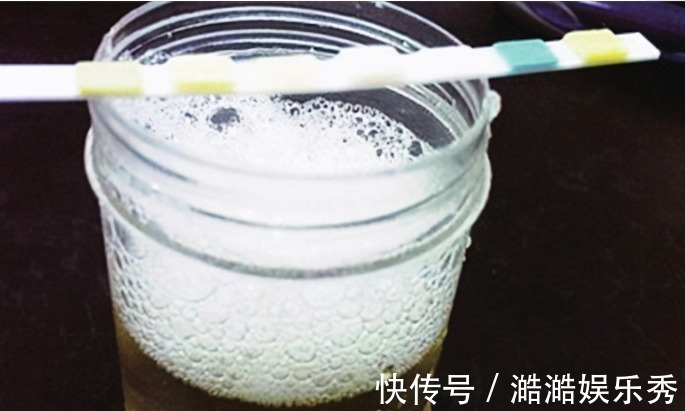 尿液|上厕所后,出现3种情况,说明你的血糖高了!糖尿病患者要注意